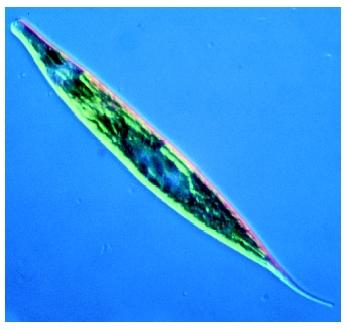 A photomicrograph of the protozoa Euglena.